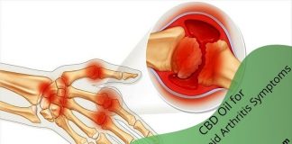 CBD Oil for Rheumatoid Arthritis Symptoms